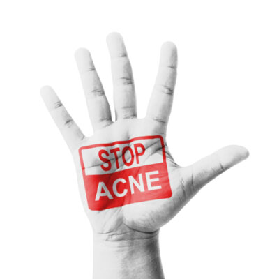Virtual Acne Consultation (Online Skin Care Approval Process)