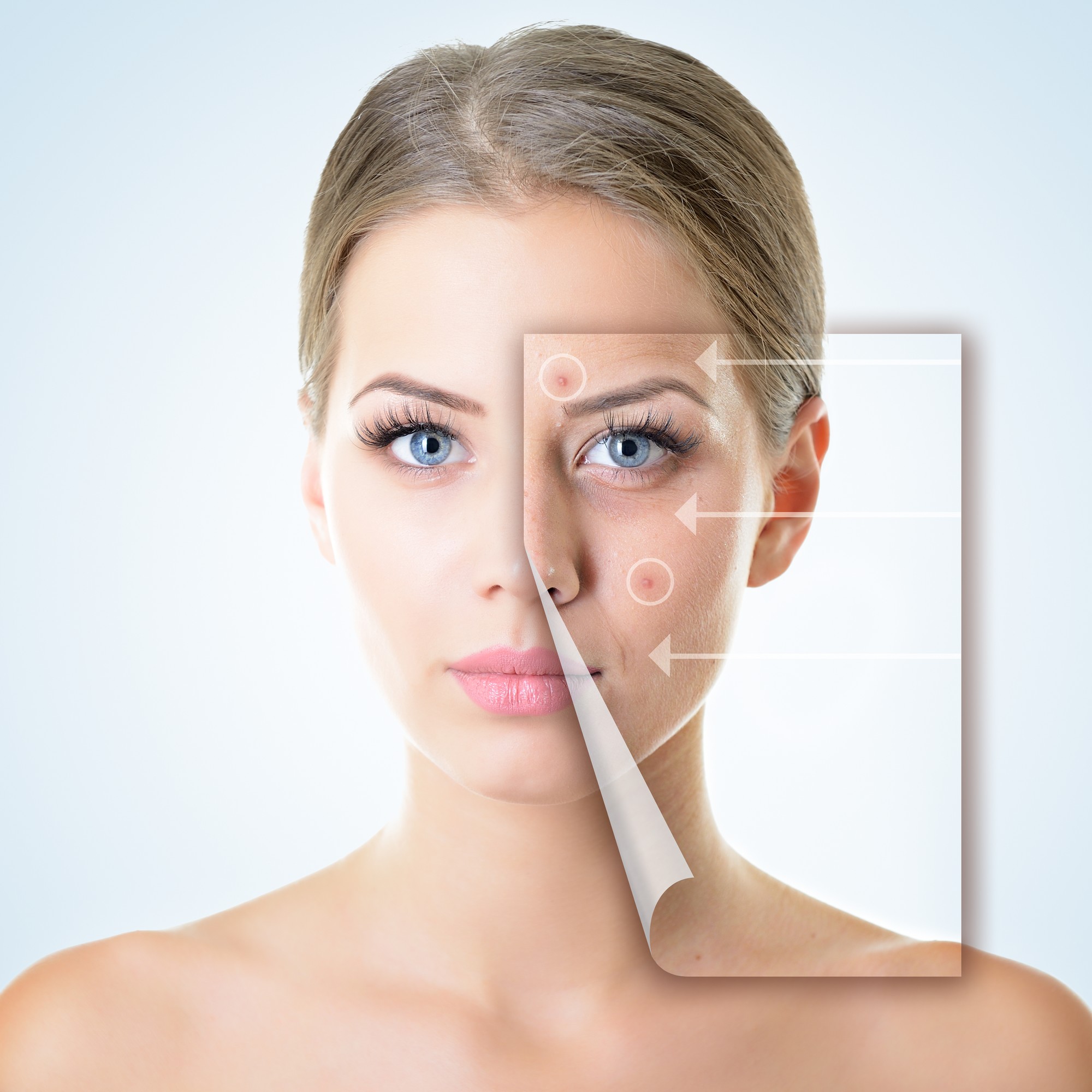 How to use Acne Products Effectively!