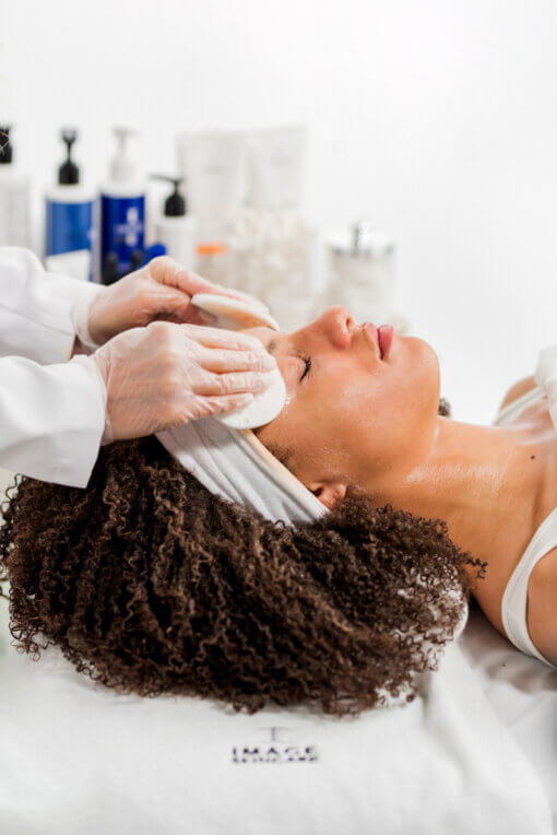 Facial and Chemical Peel - Image 5