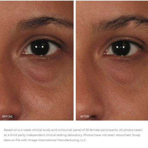 ORMEDIC® balancing eye lift gel - Image Skincare - Acne Safe - Image 2