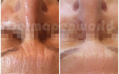 Boost Skin Love with Exosomes!