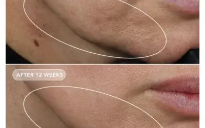 VOL.U.LIFT skin rebound complex!