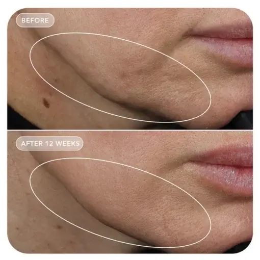 VOL.U.LIFT® - Image Skincare - Image 3