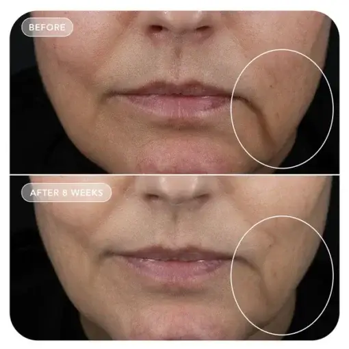 VOL.U.LIFT® - Image Skincare - Image 2