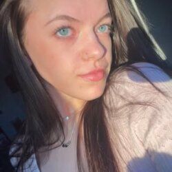 Lexi is our newest Employee at Skin and Acne Specialist! 