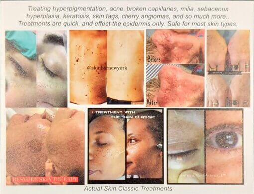 Skin Classic - Image 3