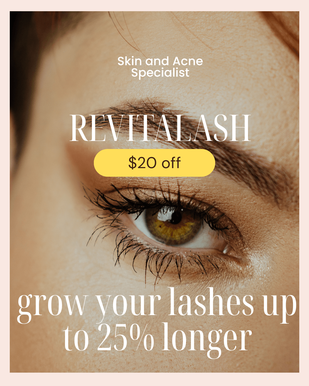 Close-up of a brown eye and brow with promo text for a lash specialist: 'Skin and Acne Specialist' and 'REVITALASH' with a yellow '$20 off' badge, advertising lash growth.