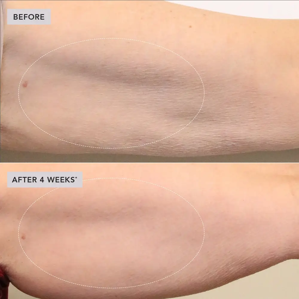 VOL.U.LIFT™ BODY GLP-1/GIP sculpt + firm treatment complex - Image Skincare - Image 6