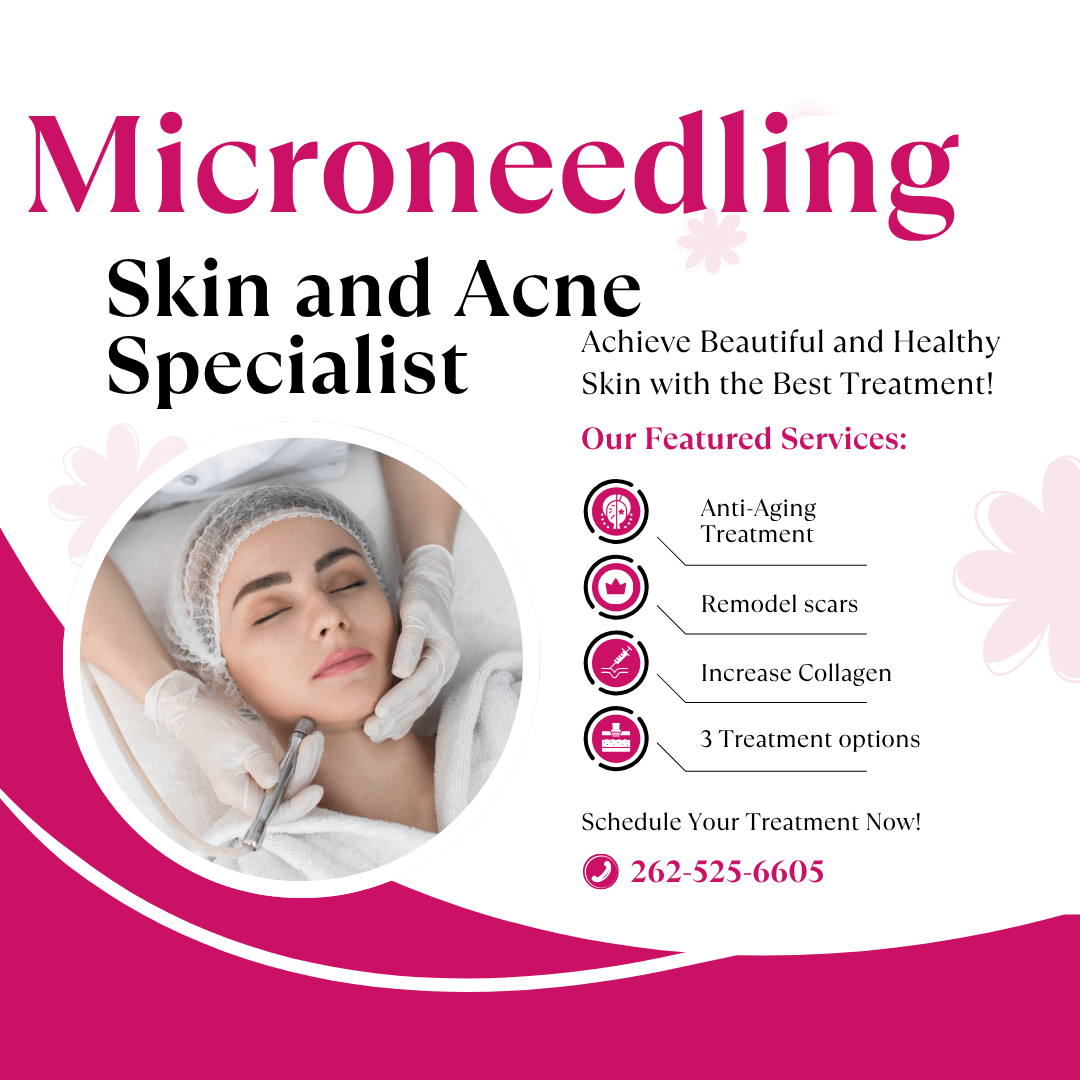 Microneedling