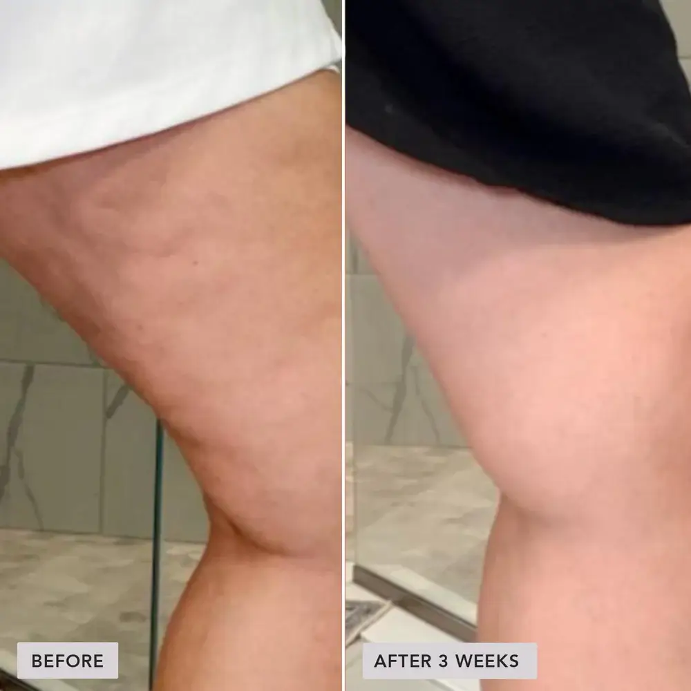 VOL.U.LIFT™ BODY GLP-1/GIP sculpt + firm treatment complex - Image Skincare - Image 5